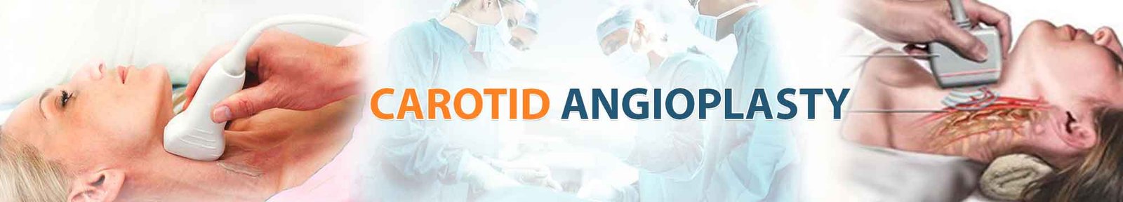 Carotid Angioplasty India