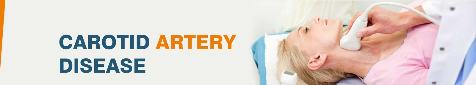 Affordable Carotid Artery Disease Surgery in India