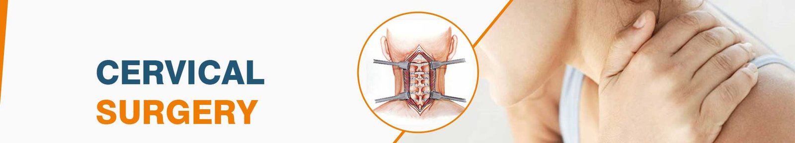 Cervical Surgery in India