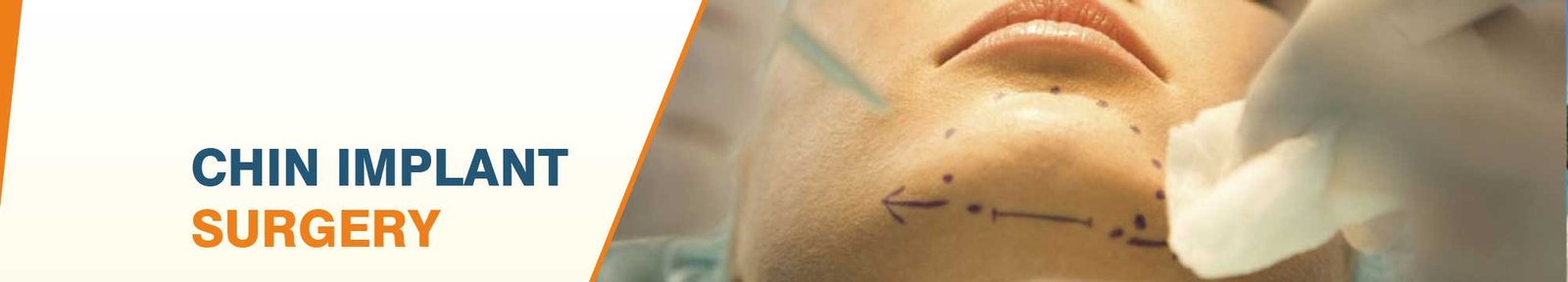 Chin Implant Surgery