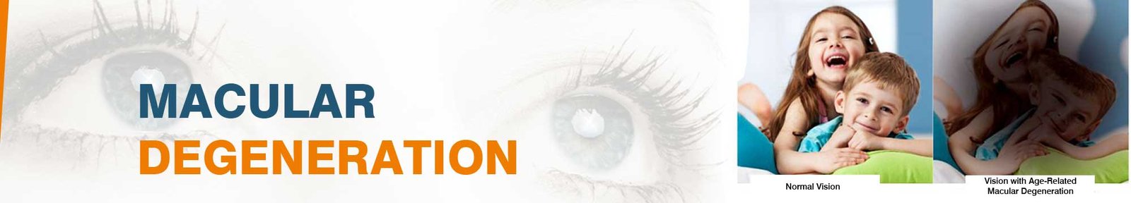 Macular Degeneration Treatment Cost