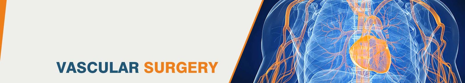 Best Vascular Surgery in India
