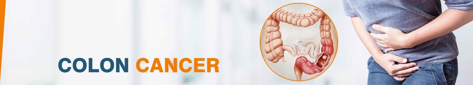 colon cancer symptoms