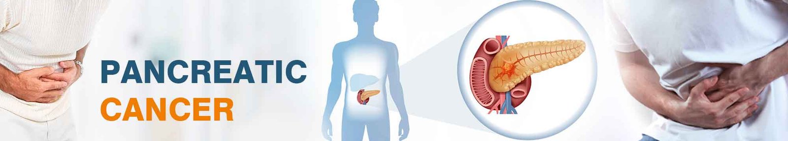 pancreas transplant cost