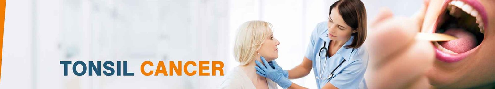 Best Tonsillectomy Surgery Hospitals